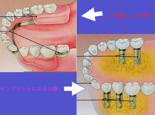 図２：メリット２