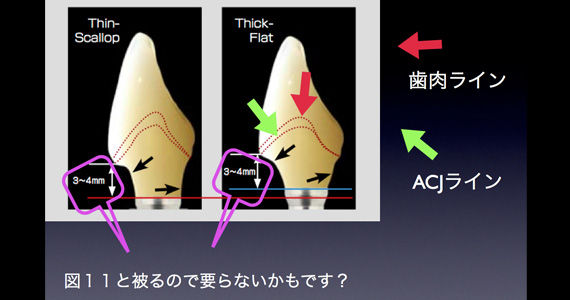 手術の段階でと仮歯の段階